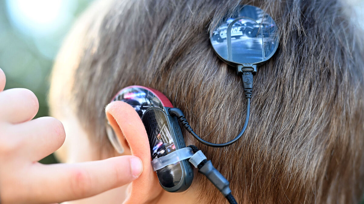 Am Hinterkopf eines siebenjährigen Jungen ist ein Cochlea-Implantat, eine Hörprothese, angebracht, das hochgradig Schwerhörigen und Ertaubten das Hören ermöglicht. Bei der Technik werden die Nervenzellen des Hörnervs elektrisch stimuliert. Dafür wird ein Elektrodenträger in die Hörschnecke eingeführt. Der äußere Teil besteht aus einem Mikrofon und einem Prozessor, der die Schallinformationen in elektrische Impulse umwandelt. Foto: Uli Deck