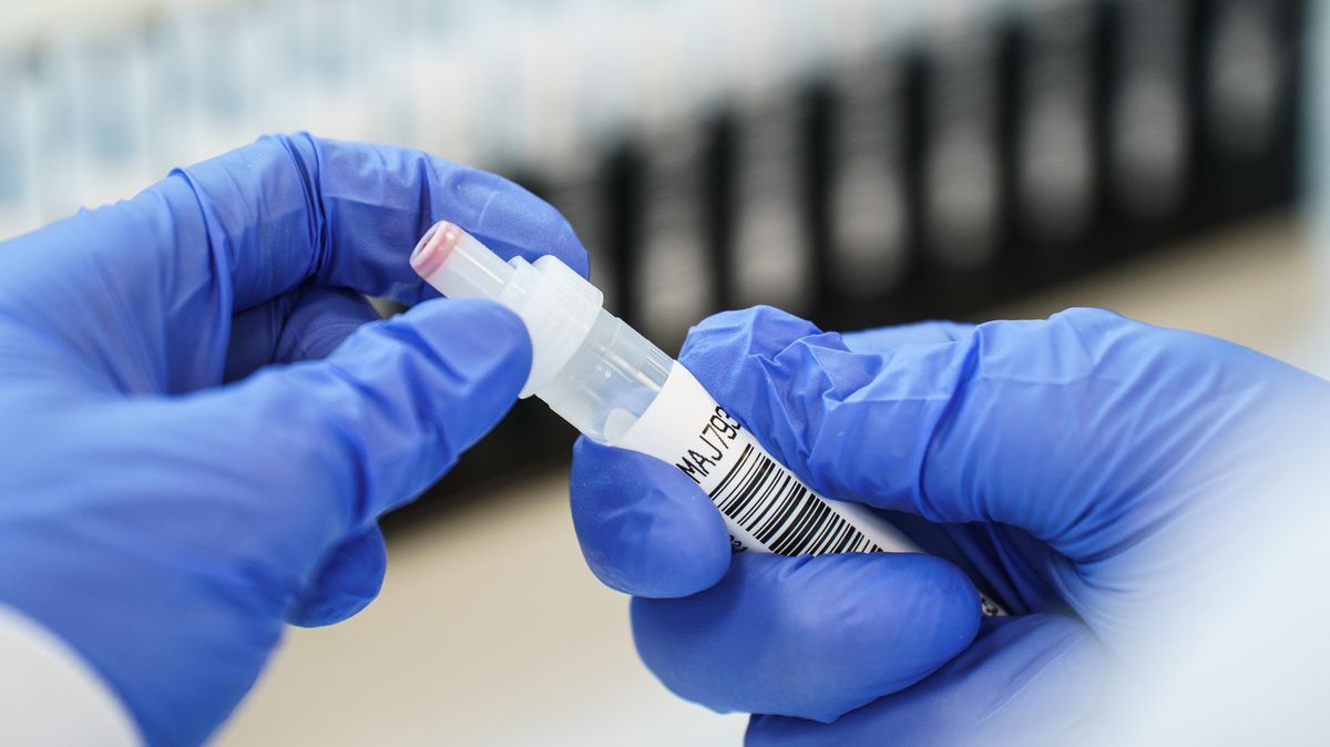 Bei rund 15 Prozent der Corona-Infektionen im Landkreis Cuxhaven handelt es sich um die britische Virus-Variante. Foto: Arnold / dpa