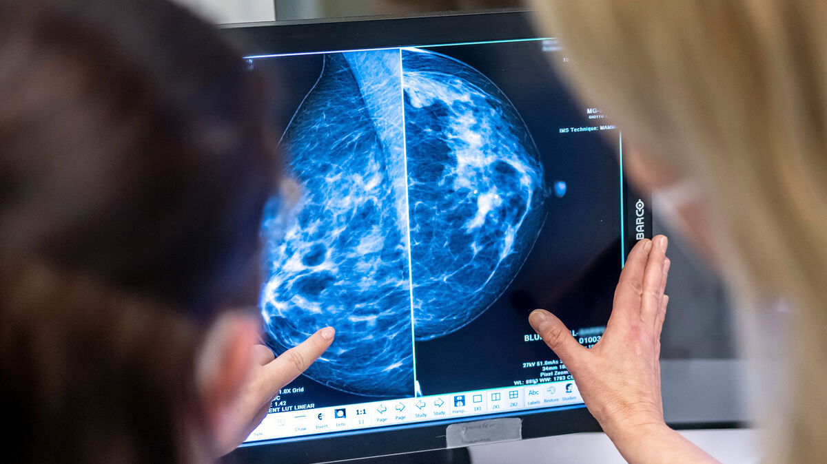 In der Mammografie wird unter anderem auf Brustkrebs untersucht. Foto: Hannibal Hanschke/dpa