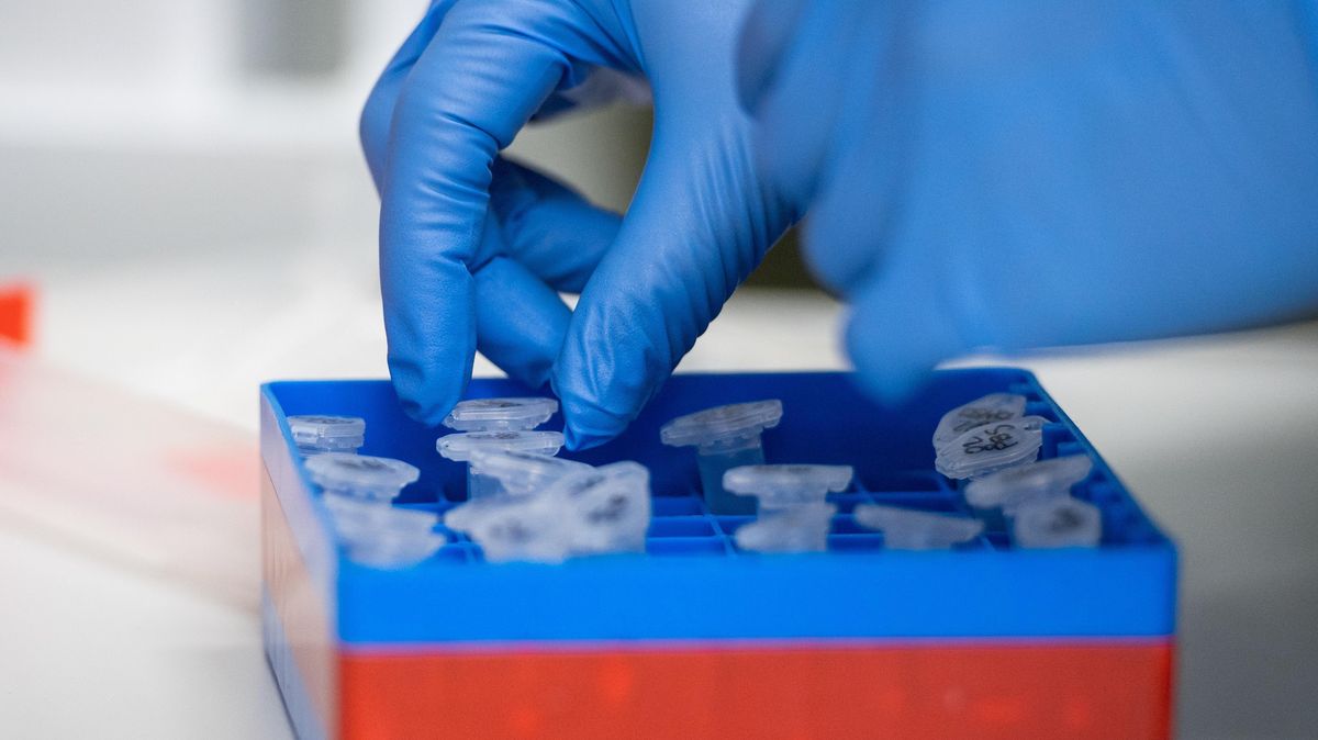 Die Statistik des Robert-Koch-Instituts täuscht. Foto: Christophe Gateau/dpa